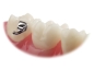 Preview: VIPER™, Bondable buccal tube, Mini (tooth 37),  .018", Torque -25°, Offset 0°