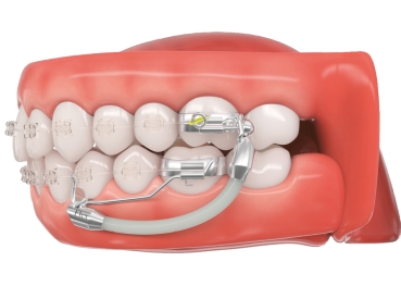 Flex Developer™ 2.0, variabele lengte, 10 stuks voor rechterzijde