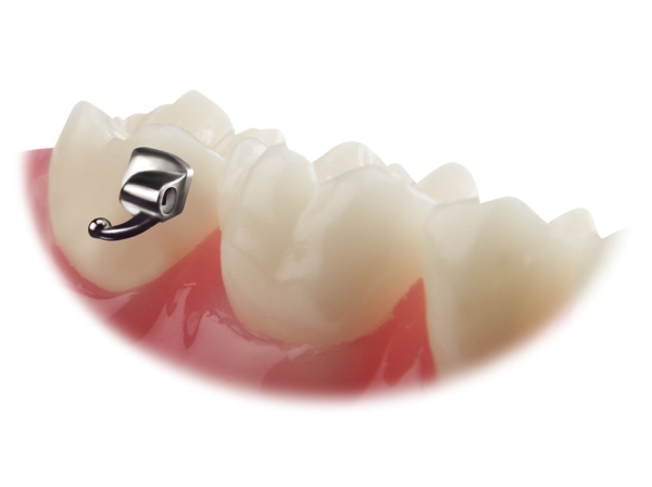 VIPER™, Bondable buccal tube, Mini (tooth 37),  .018", Torque -25°, Offset 0°